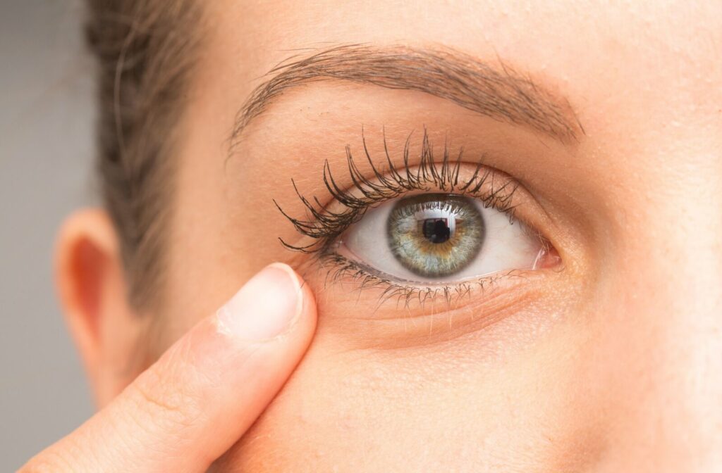 Close-up of an eye with a finger touching the lower eyelid, illustrating signs of eye irritation or dryness.